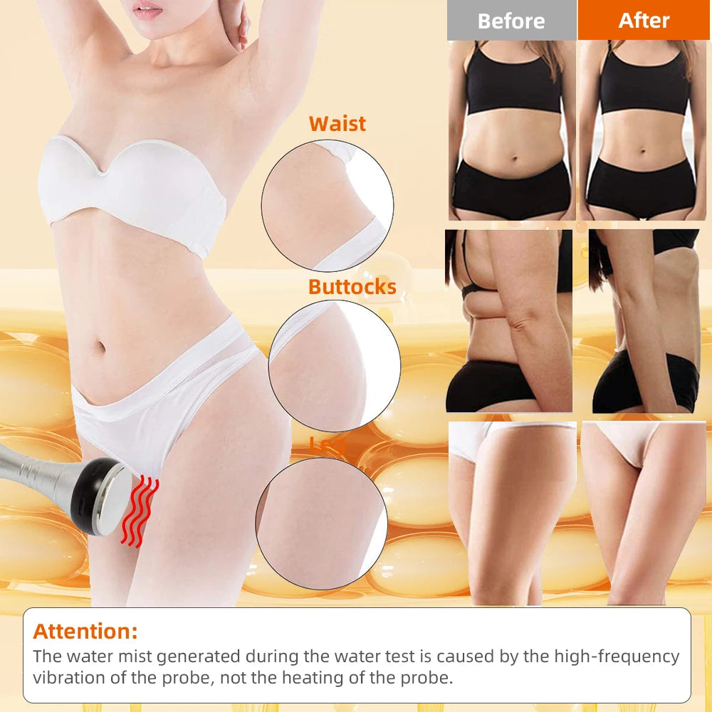 New 4 in 1 Cavitation Machine 40k Ultrasonic RF Shape Vacuum Frequency Liposuction Weight Loss Slimming Skin Tightening Liftin