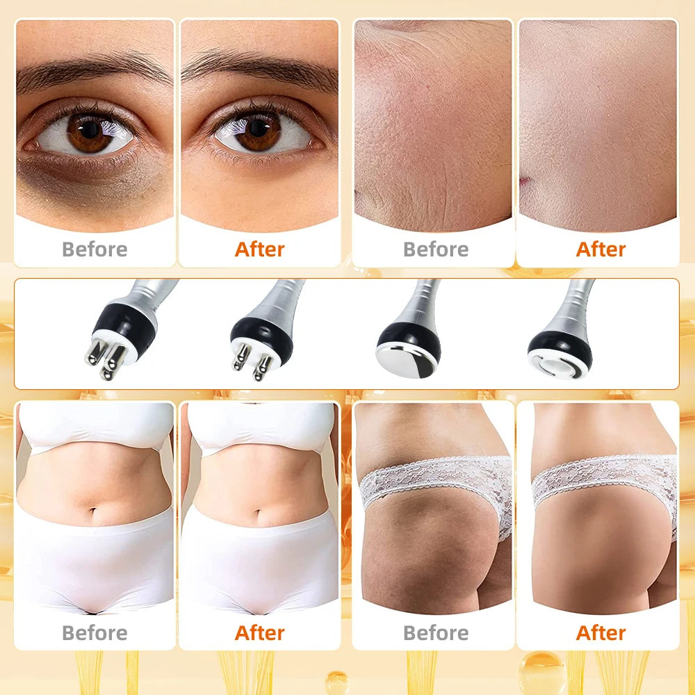 New 4 in 1 Cavitation Machine 40k Ultrasonic RF Shape Vacuum Frequency Liposuction Weight Loss Slimming Skin Tightening Liftin